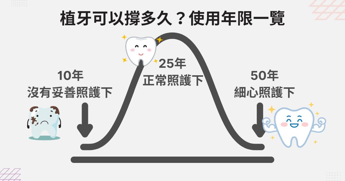 植牙可以撐多久？了解植牙使用年限究竟有多長